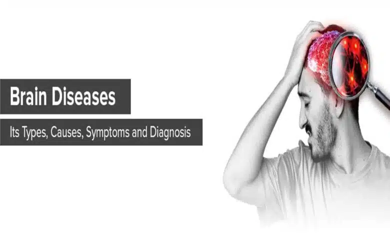Brain Disorders: Causes, Symptoms, Diagnosis