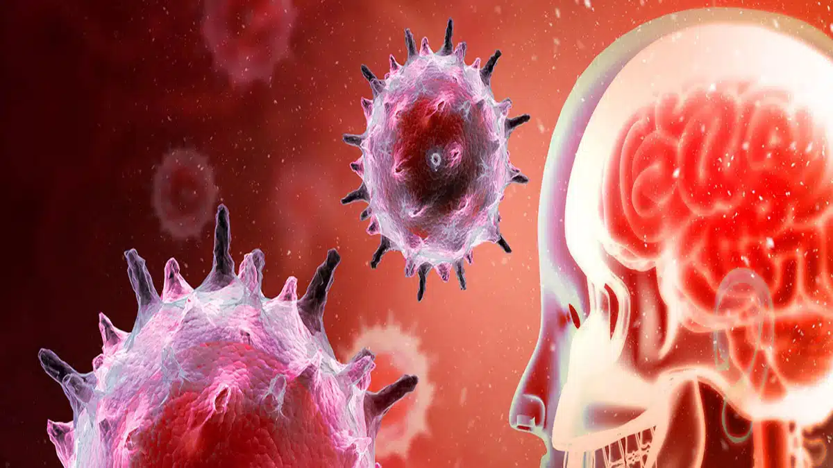 Brain Disorders: Causes, Symptoms, Diagnosis