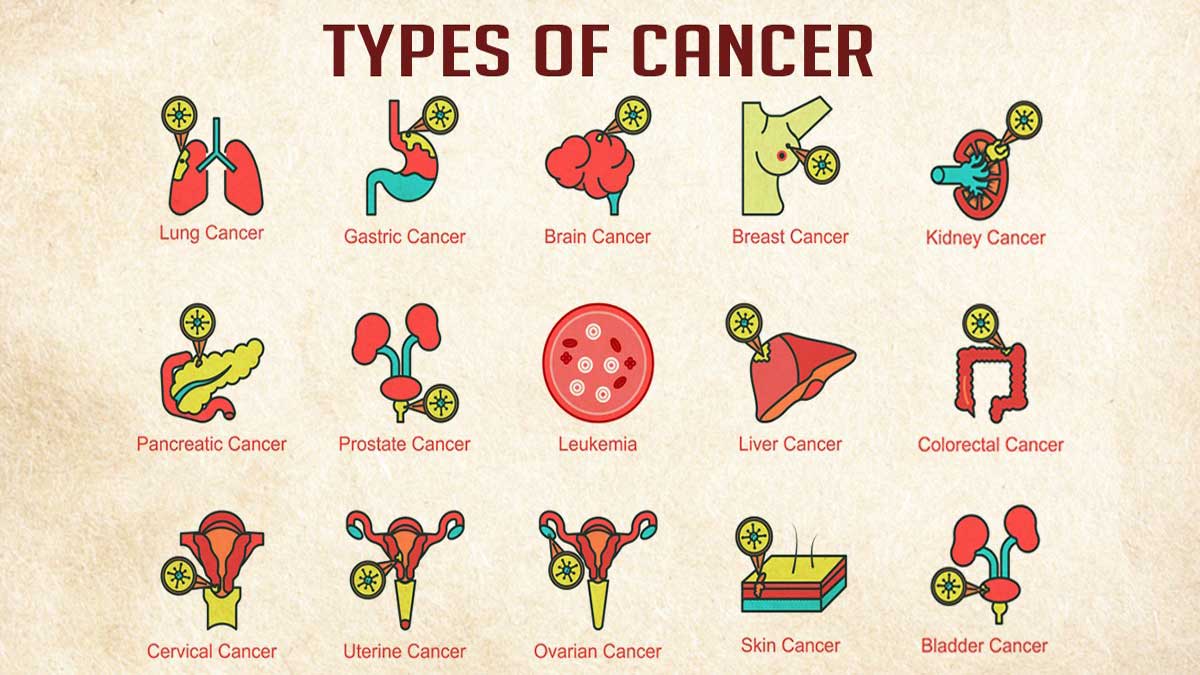 Cancer: Causes, Symptoms, Diagnosis, Treatment
