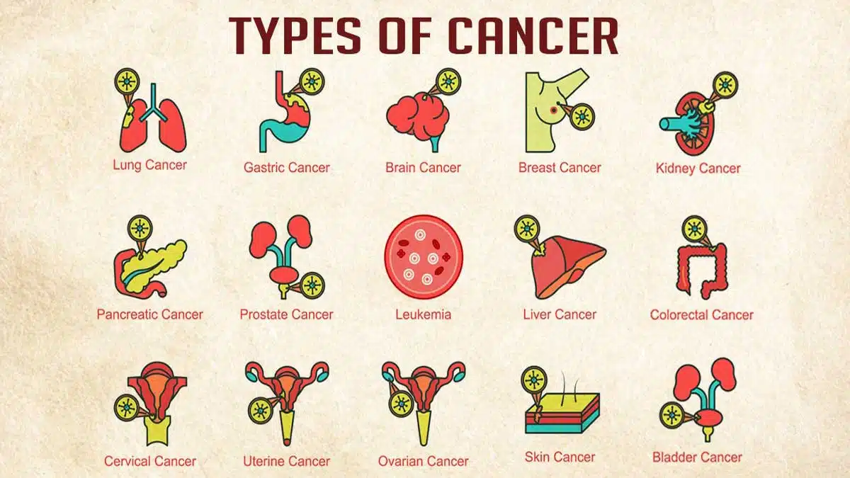 Cancer: Causes, Symptoms, Diagnosis, Treatment