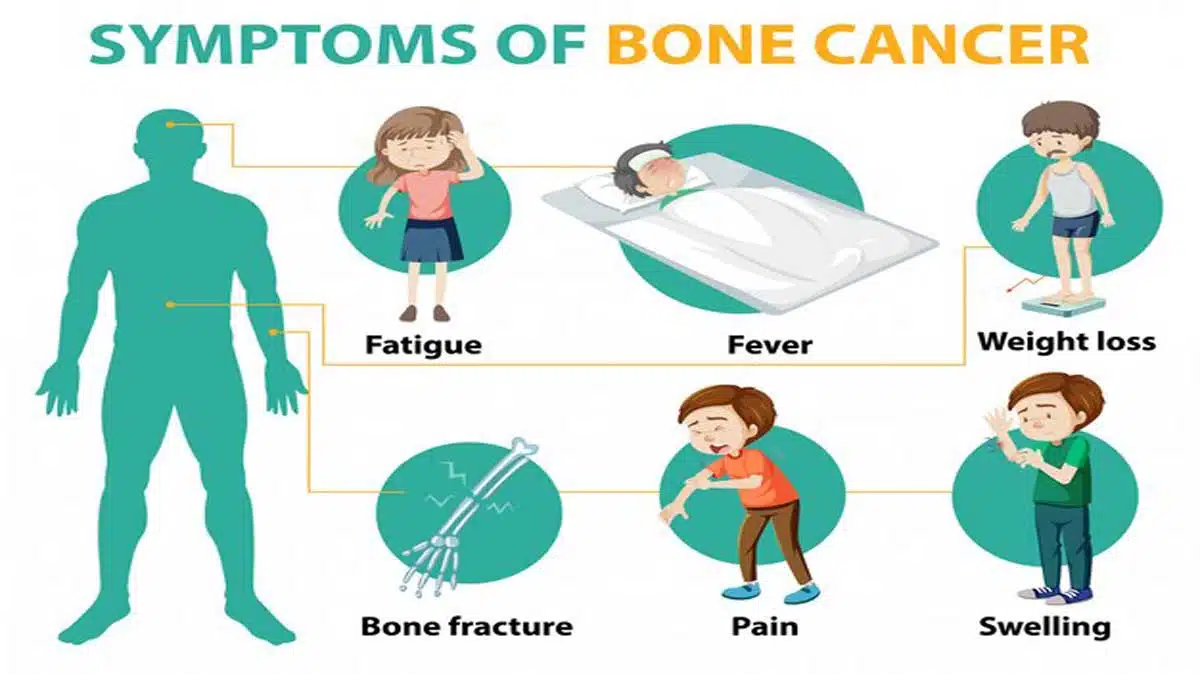 Cancer: Causes, Symptoms, Diagnosis, Treatment