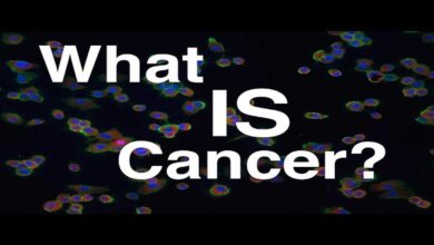 Cancer: Causes, Symptoms, Diagnosis, Treatment