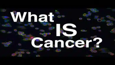 Cancer: Causes, Symptoms, Diagnosis, Treatment