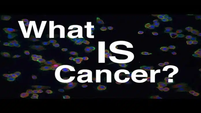 Cancer: Causes, Symptoms, Diagnosis, Treatment