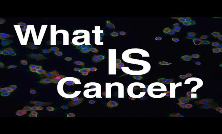 Cancer: Causes, Symptoms, Diagnosis, Treatment