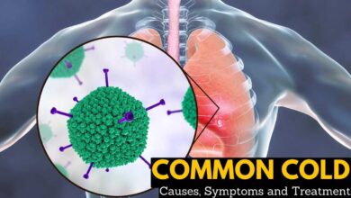 Complete Information About Common Cold