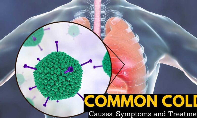 Complete Information About Common Cold