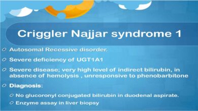 Crigler-Najjar Syndrome: Causes, Symptoms
