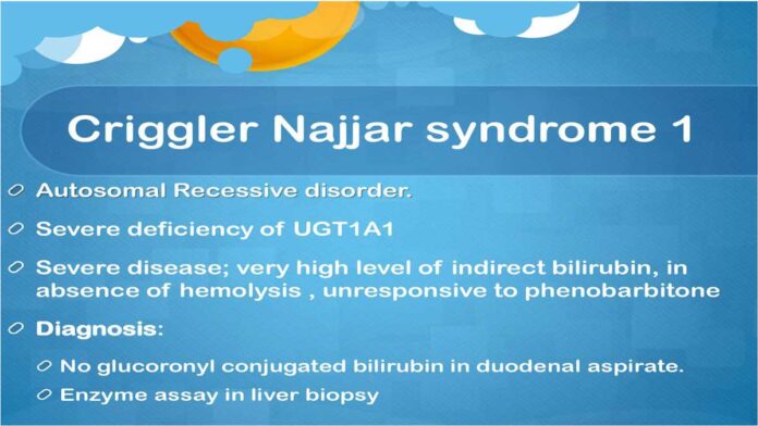 Crigler-Najjar Syndrome: Causes, Symptoms