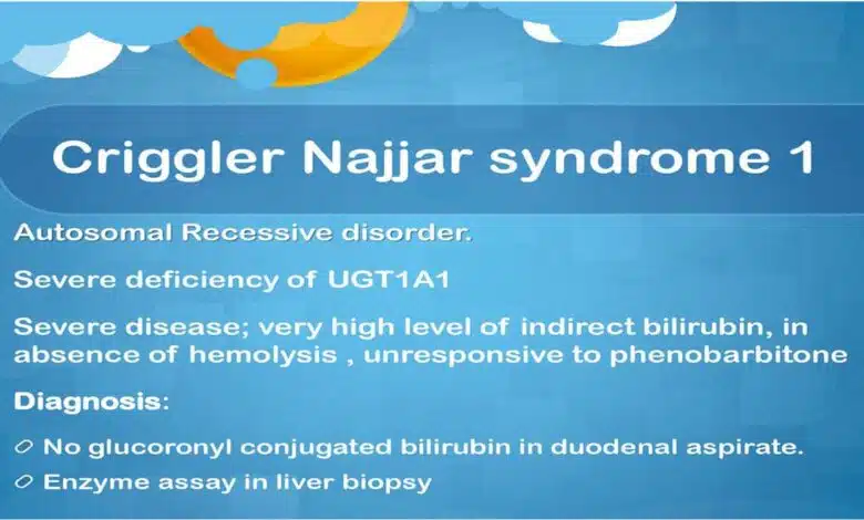 Crigler-Najjar Syndrome: Causes, Symptoms