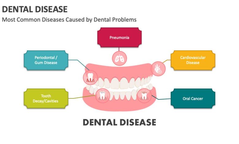 Dental Diseases: Causes, Symptoms, Treatment