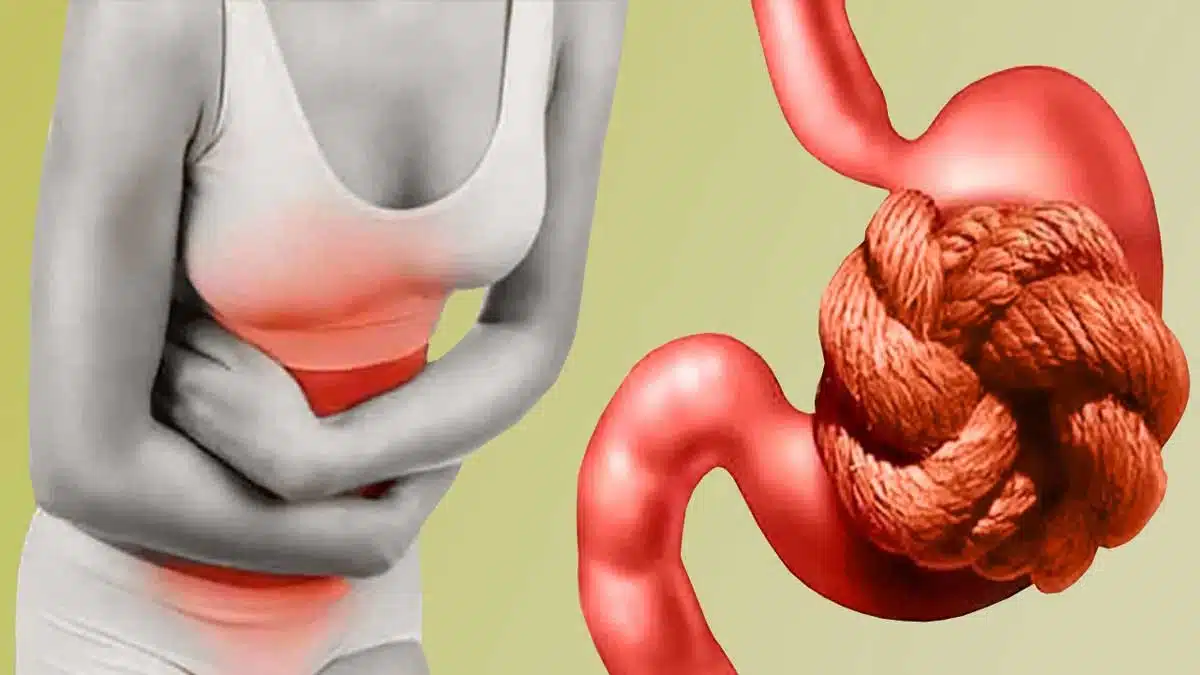 Digestive Disorders: Causes, Symptoms