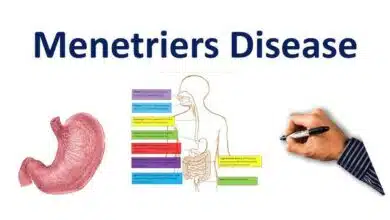 Ménétrier's Disease: A Comprehensive Guide