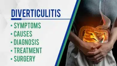 Diverticulitis: Symptoms, Causes, Diagnosis