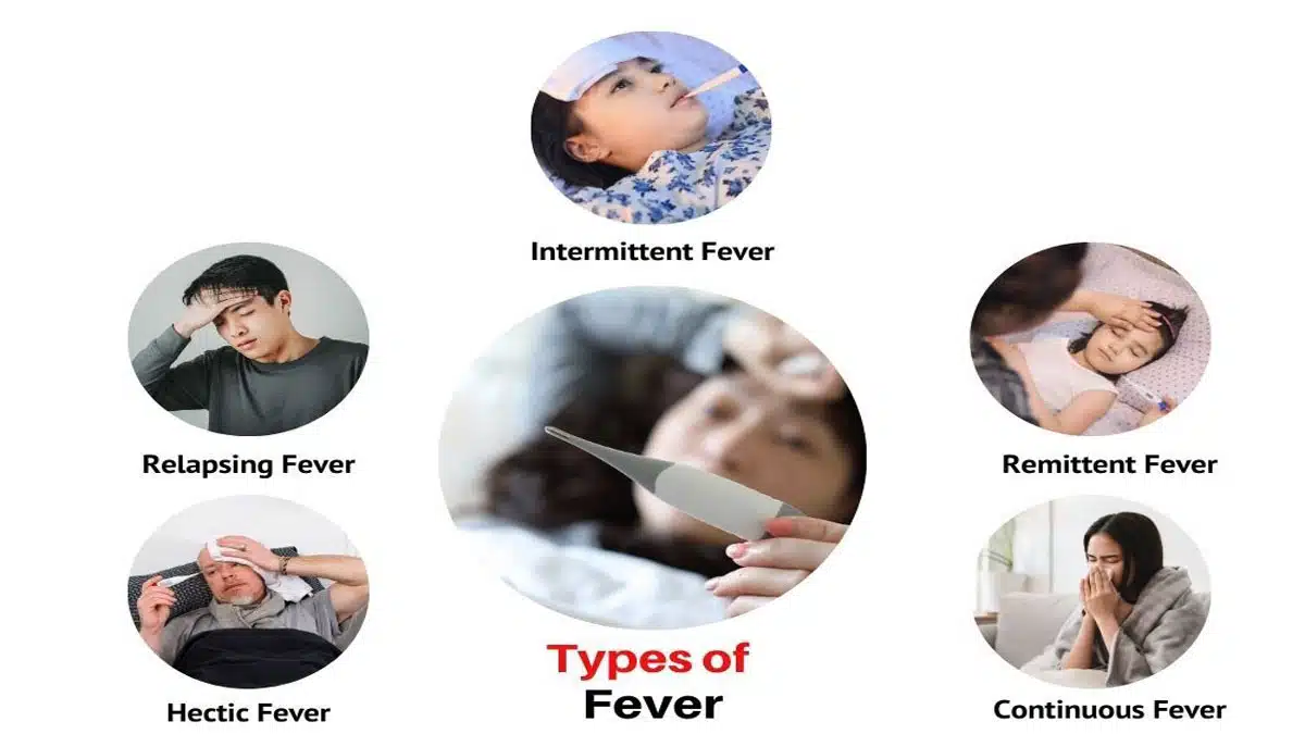 Fever: Causes, Symptoms, Types, Diagnosis
