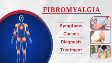 Fibromyalgia: Causes, Symptoms, and Diagnosis