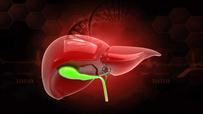 Gallbladder Disease: Causes, Symptoms