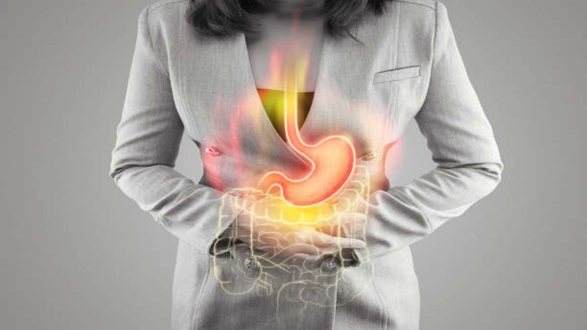 Gastroesophageal Reflux Disease (GERD): Causes, Symptoms