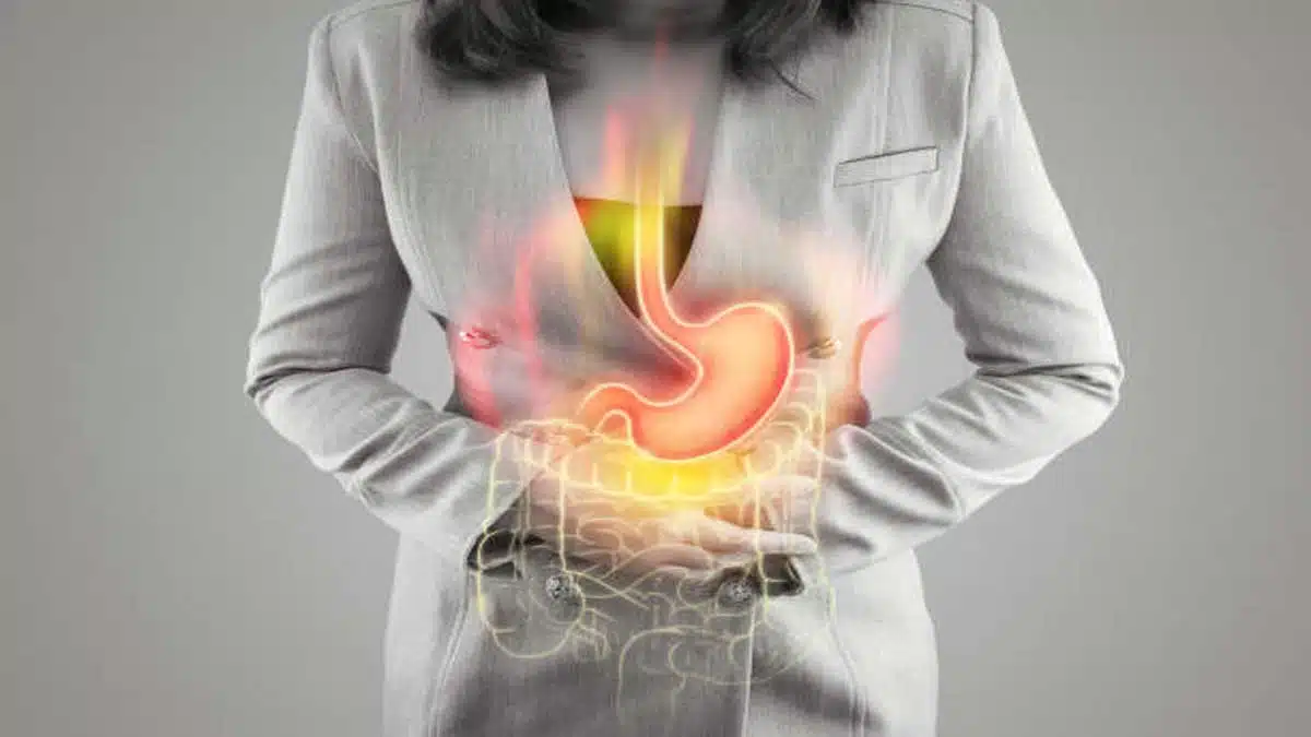 Gastroesophageal Reflux Disease (GERD): Causes, Symptoms