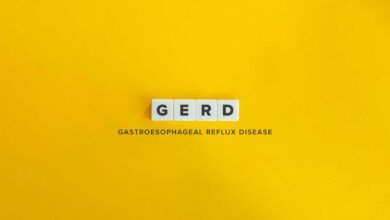 Gastroesophageal Reflux Disease (GERD): Causes, Symptoms