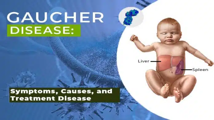 Gaucher Disease: Complete Information, Causes