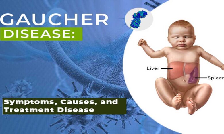 Gaucher Disease: Complete Information, Causes