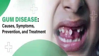 Gum Problems and Diseases: Causes