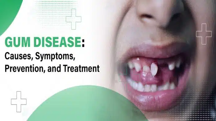 Gum Problems and Diseases: Causes