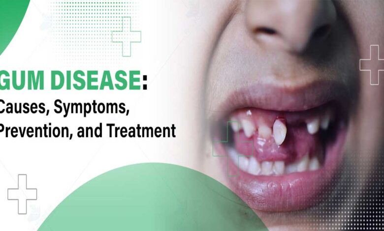 Gum Problems and Diseases: Causes