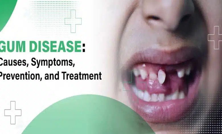 Gum Problems and Diseases: Causes