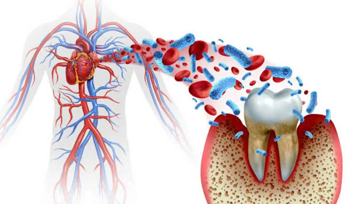 Gum Problems and Diseases: Causes