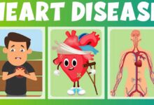 Heart Disease: Causes and Symptoms