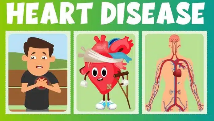 Heart Disease: Causes and Symptoms