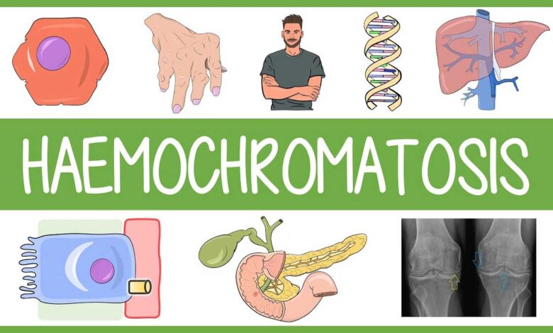 Hemochromatosis: Causes, Symptoms, Diagnosis