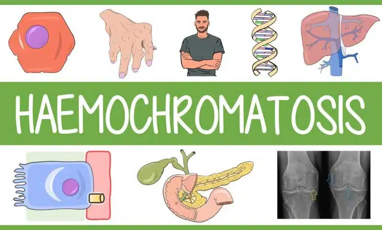 Hemochromatosis: Causes, Symptoms, Diagnosis