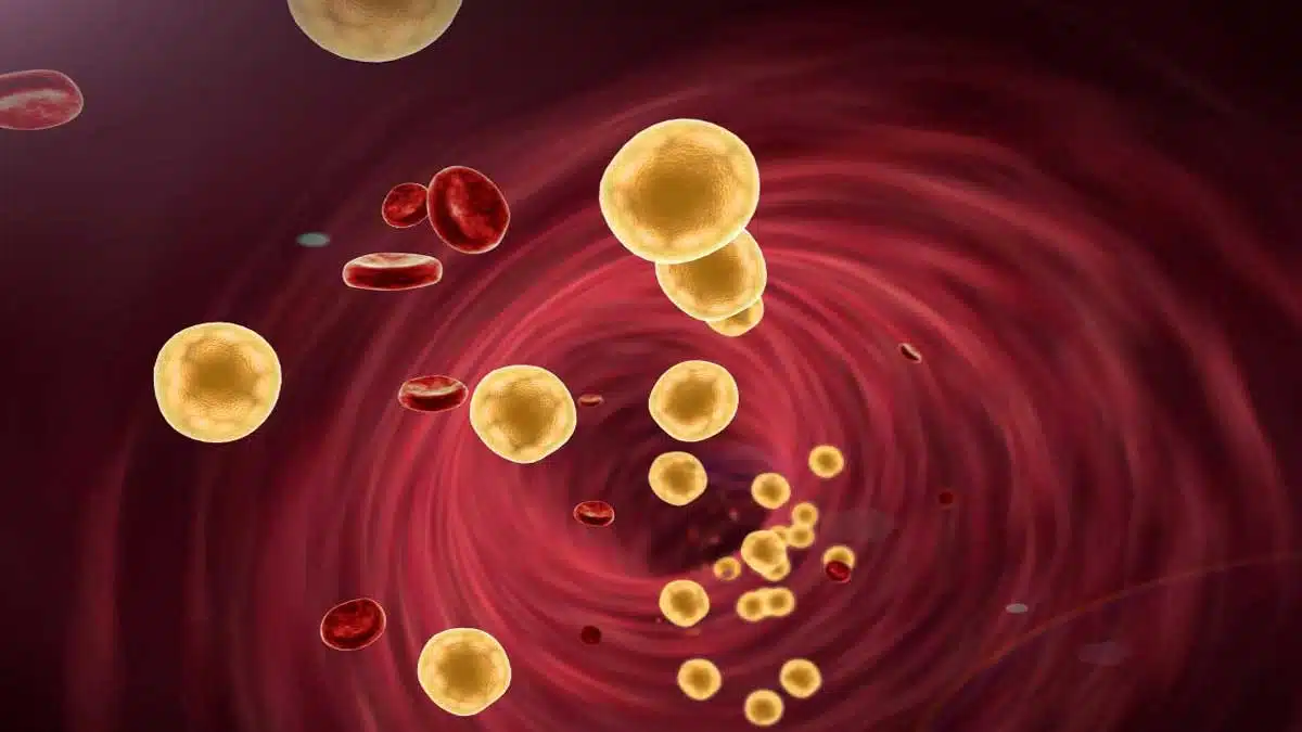 Information About Hyperlipoproteinemia Disease