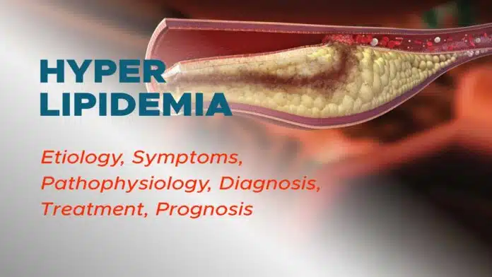 Information About Hyperlipoproteinemia Disease