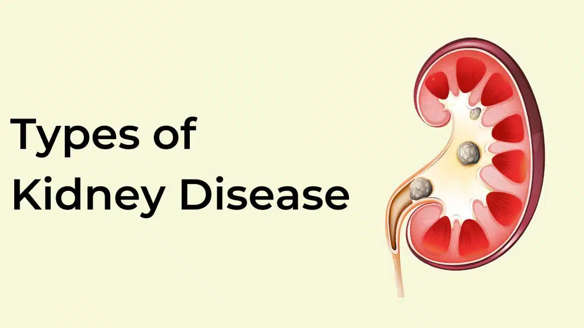 Kidney Disease: Causes and Symptoms