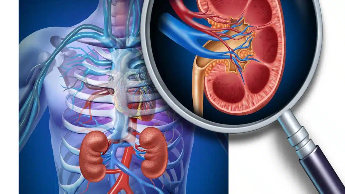 Kidney Disease: Causes and Symptoms