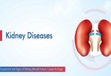 Kidney Disease: Causes and Symptoms