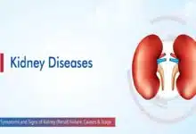 Kidney Disease: Causes and Symptoms