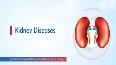Kidney Disease: Causes and Symptoms