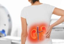 Kidney Silent bomb! Know 10 remedies of Baba Ramdev