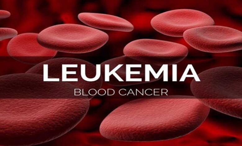 Complete Information About Leukemia