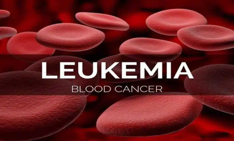 Complete Information About Leukemia