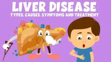 Liver Disease: Causes, Symptoms