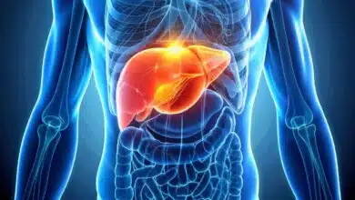 Liver Problems: Causes, Symptoms, Diagnosis, Treatment