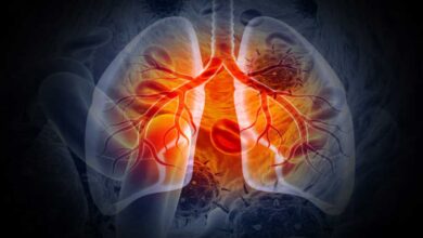 Lung Diseases: Symptoms, Causes, Types