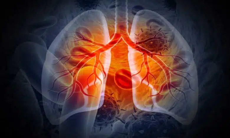 Lung Diseases: Symptoms, Causes, Types