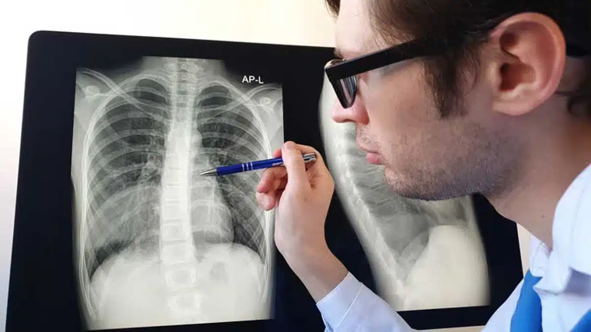 Lung Diseases: Symptoms, Causes, Types